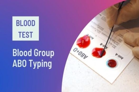 Rajkotupdates. news: emm-negative-Rare-Blood-Group-found-in-Rajkot-man-11th-such-Case-Worldwide